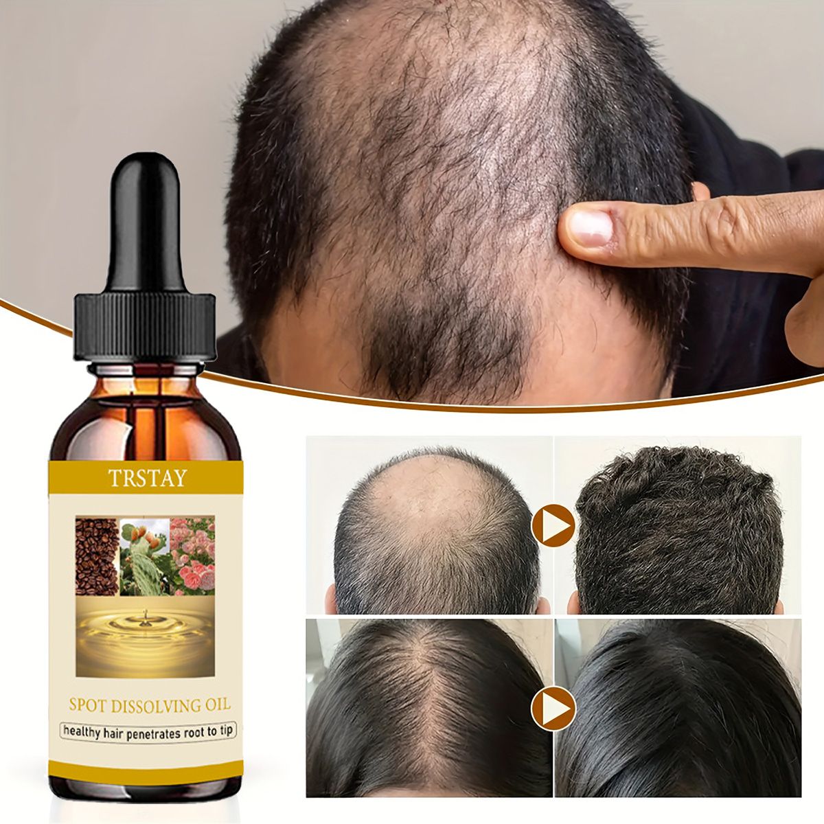 Beard Oil Growth - 50ML aceite para el crecimiento de