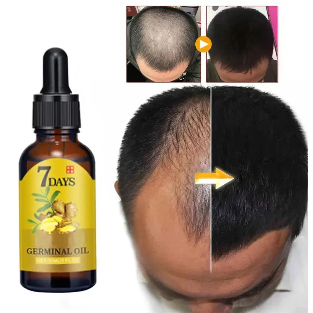Beard Oil Growth - Aceite esencial de jengibre para el