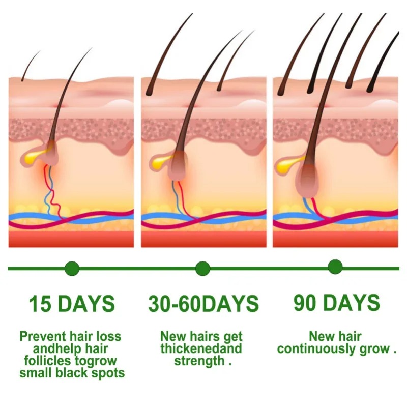 Suero para el crecimiento del  - Beard Oil Growth reseña y precio