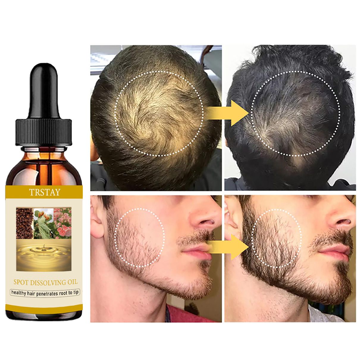 50ML aceite para el crecimient - Beard Oil Growth reseña y precio