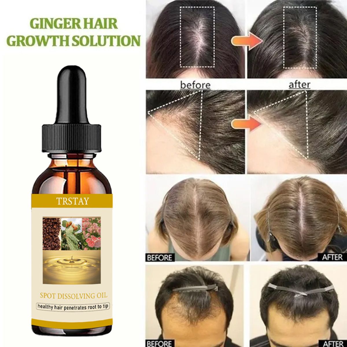 50ML aceite para el crecimient - Beard Oil Growth reseña y precio
